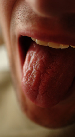tongue diagnosis