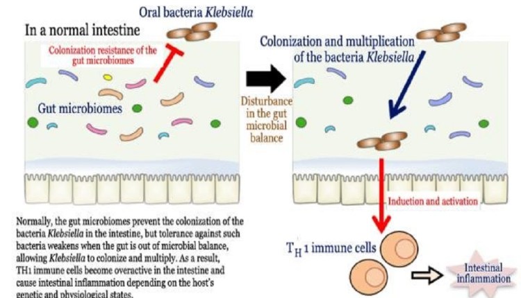 A gut "out of balance" allows colonization by the bacteria Klebsiella, and a cascade immune response which may underpin IBD and gut health.